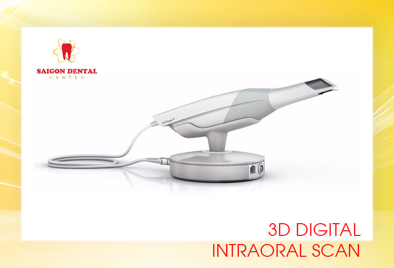 3D digital scanning