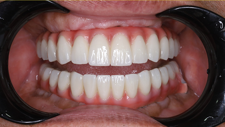 Sau