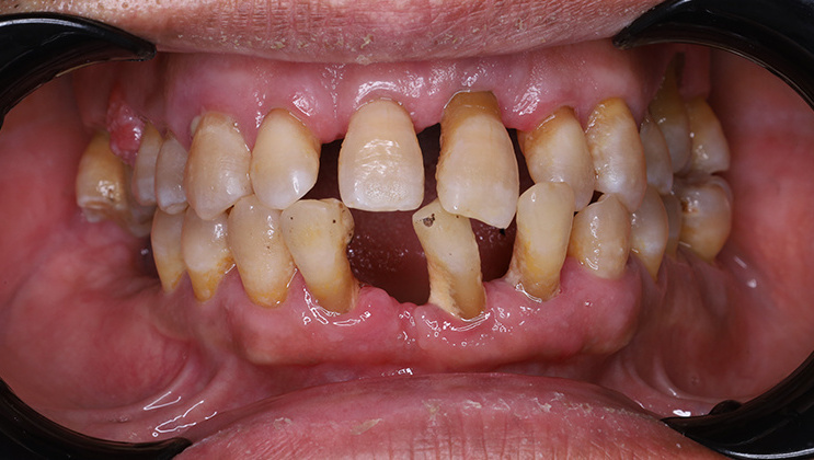 Trước