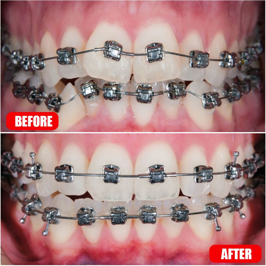 Orthodontics