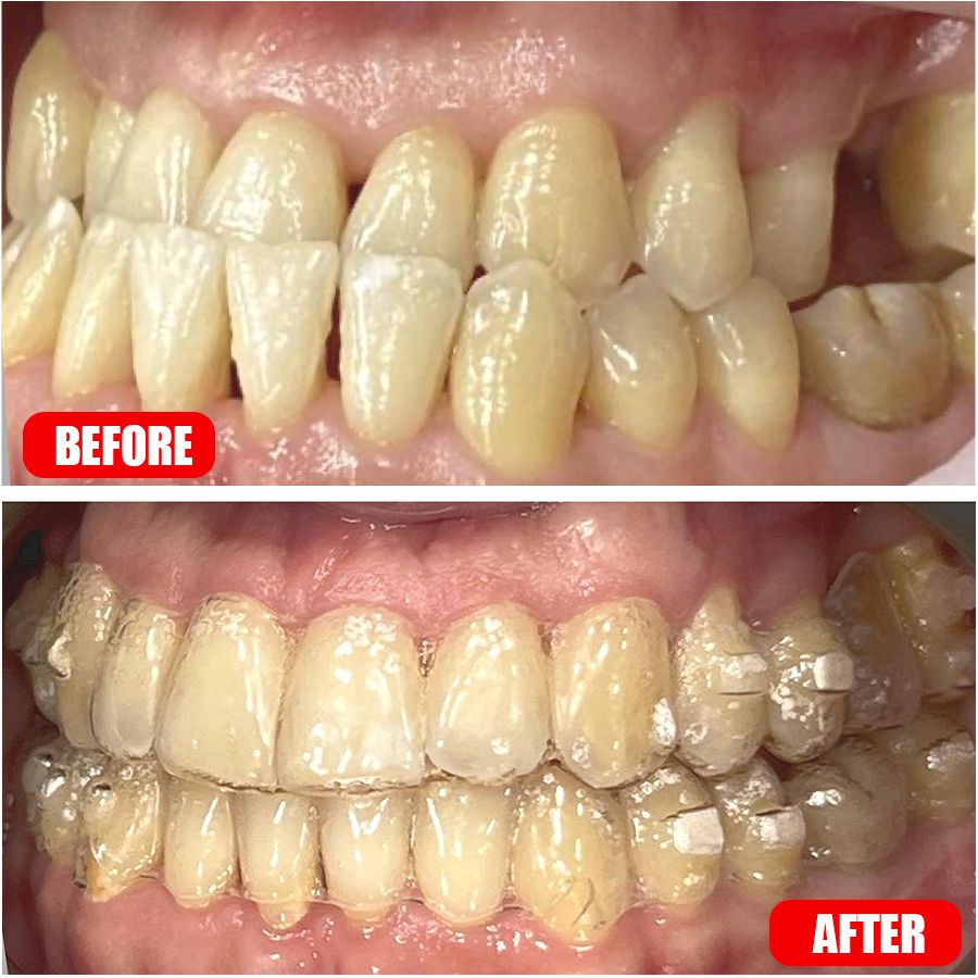 Orthodontics